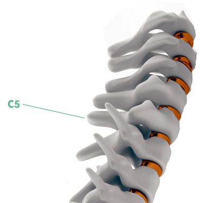 Coluna Cervical C5
